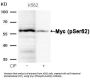 Phospho-MYC (Ser62) Antibody