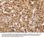 SMARCB1 Antibody