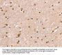 SMARCB1 Antibody