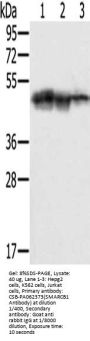 SMARCB1 Antibody