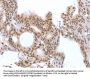 CTBP2 Antibody