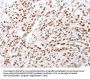 CTBP2 Antibody
