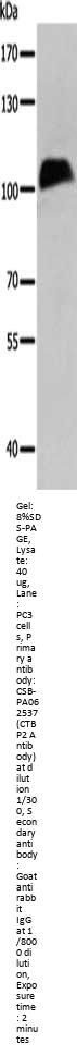 CTBP2 Antibody
