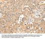 S100A12 Antibody