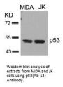TP53 (Ab-15) Antibody