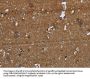 GALT Antibody