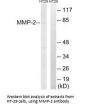 MMP2 Antibody