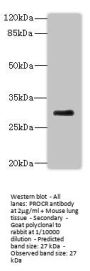 PROCR Antibody