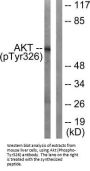 Phospho-AKT1 (Tyr326) Antibody