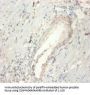 FGF21 Antibody