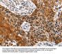 HOXB1 Antibody