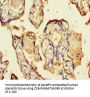 CSF2 Antibody
