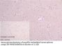 IFNA2 Antibody