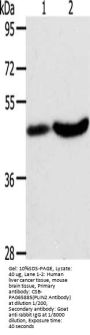 PLIN2 Antibody