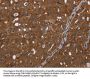 HDAC7 Antibody