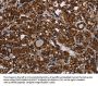 HDAC7 Antibody