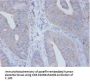 IL12B Antibody