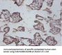 IL12B Antibody
