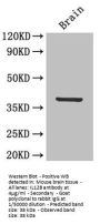 IL12B Antibody