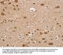 RUNX1T1 Antibody