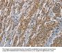 AGER Antibody