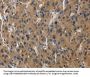 AGER Antibody
