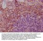 IL3 Antibody