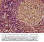 IL4 Antibody