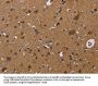NDUFS8 Antibody