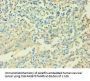IL6 Antibody