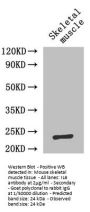 IL6 Antibody
