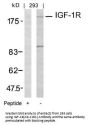 IGF1R (Ab-1161) Antibody