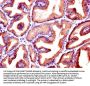 KLK3 Antibody