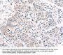 ROR1 Antibody