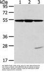 TUBA1C Antibody