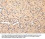 Rabbit anti-human COL8A2 polyclonal antibody