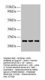 LCN2 Antibody
