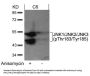 Phospho-MAPK8/MAPK9/MAPK10 (Thr183/Tyr185) Antibody