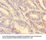 MMP2 Antibody
