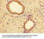 MMP2 Antibody