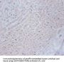 CSRP2 Antibody