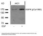 Phospho-EGFR (Tyr1092) Antibody