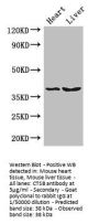 CTSB Antibody
