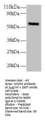 MMP1 Antibody