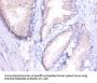 MMP1 Antibody