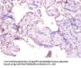 MMP1 Antibody