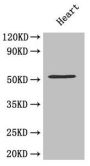 MMP10 Antibody