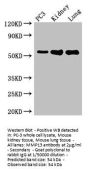 MMP13 Antibody