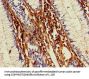 MMP13 Antibody