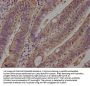PCSK9 Antibody